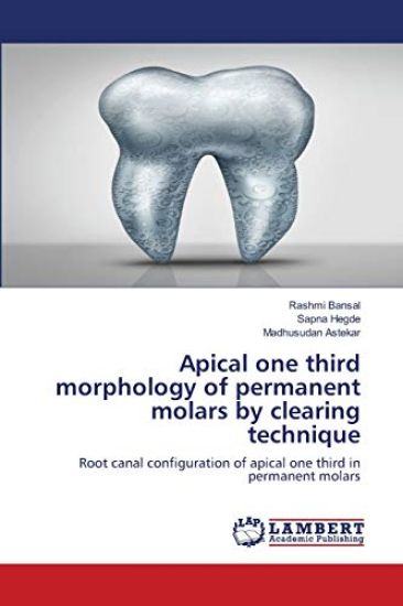 Apical one third morphology of permanent molars by clearing technique