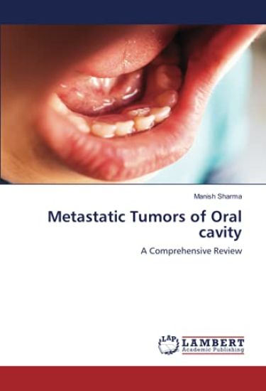 Metastatic Tumors of Oral cavity – Manish Sharma, kirjan kansikuva