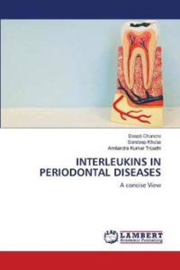 Interleukins in Periodontal Diseases