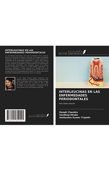 INTERLEUCINAS EN LAS ENFERMEDADES PERIODONTALES