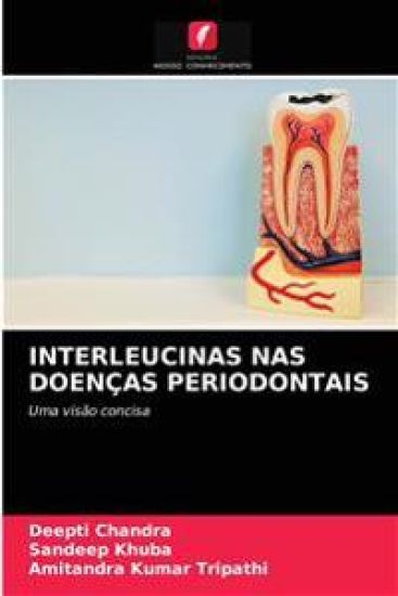 Interleucinas NAS Doenças Periodontais