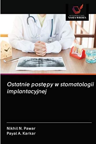 Ostatnie postepy w stomatologii implantacyjnej