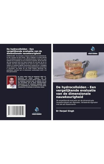 De hydrocolloïden - Een vergelijkende evaluatie van de dimensionale nauwkeurigheid