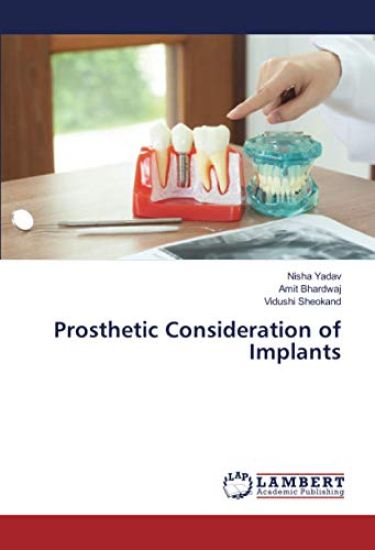 Prosthetic Consideration of Implants
