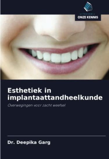 Esthetiek in implantaattandheelkunde
