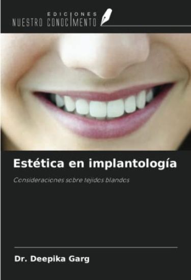 Estética en implantología