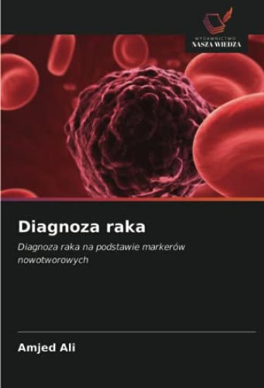 Diagnoza raka