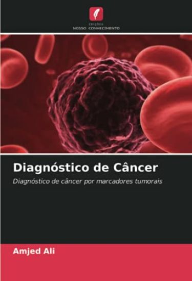 Diagnóstico de Câncer