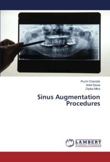 Sinus Augmentation Procedures