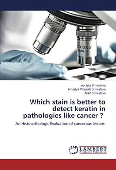 Which stain is better to detect keratin in pathologies like cancer ?