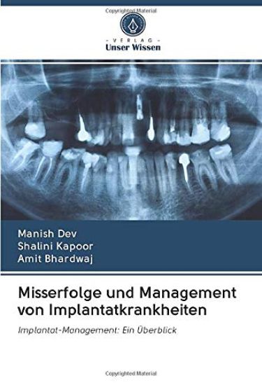 Misserfolge und Management von Implantatkrankheiten