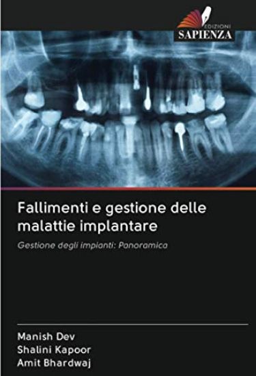 Fallimenti e gestione delle malattie implantare