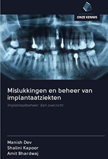 Mislukkingen en beheer van implantaatziekten