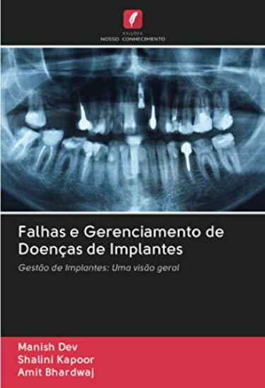 Falhas e Gerenciamento de Doenças de Implantes