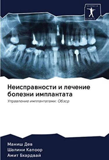 Neisprawnosti i lechenie bolezni implantata