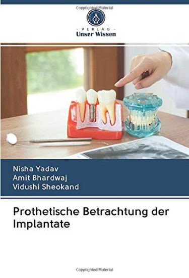 Prothetische Betrachtung der Implantate