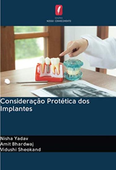 Consideração Protética dos Implantes