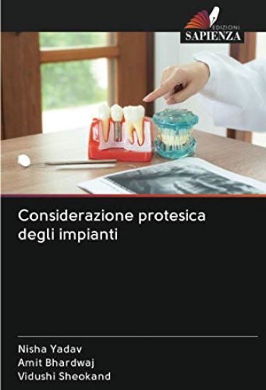 Considerazione protesica degli impianti
