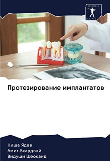 Protezirowanie implantatow