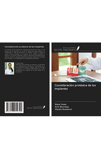 Consideración protésica de los implantes