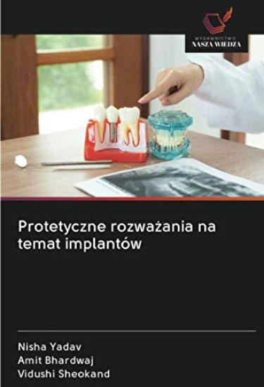 Protetyczne rozwa¿ania na temat implantów