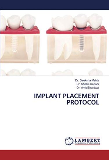 IMPLANT PLACEMENT PROTOCOL