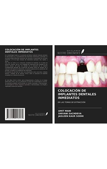 COLOCACIÓN DE IMPLANTES DENTALES INMEDIATOS
