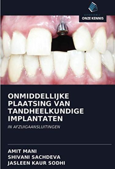 ONMIDDELLIJKE PLAATSING VAN TANDHEELKUNDIGE IMPLANTATEN