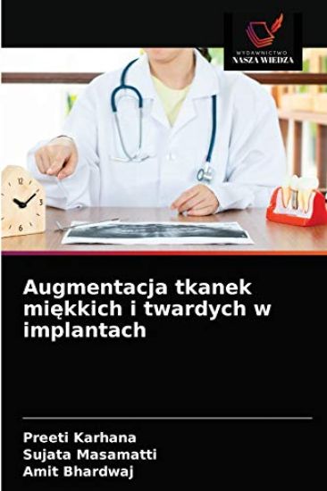 Augmentacja tkanek miekkich i twardych w implantach