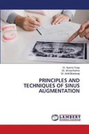 Principles and Techniques of Sinus Augmentation