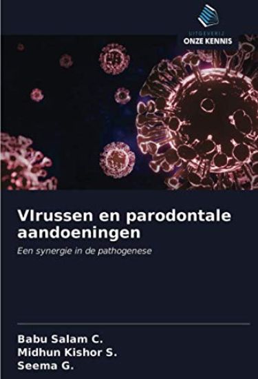 VIrussen en parodontale aandoeningen