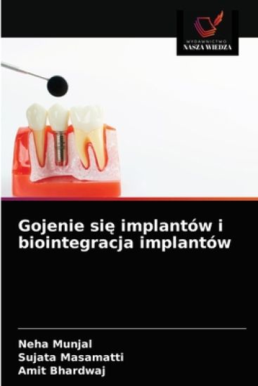 Gojenie sie implantów i biointegracja implantów