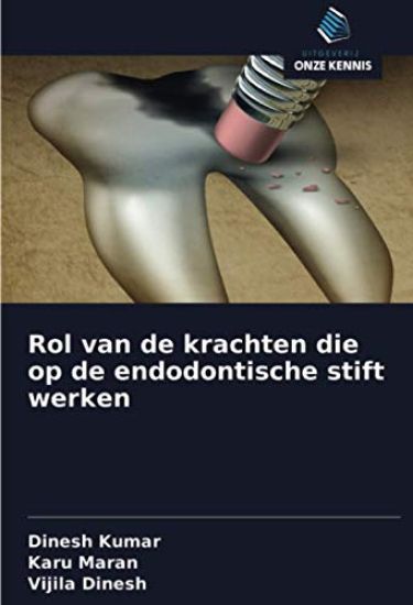 Rol van de krachten die op de endodontische stift werken