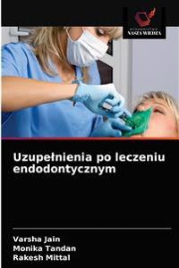 Uzupelnienia po leczeniu endodontycznym