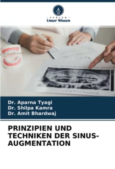 Prinzipien Und Techniken Der Sinus-Augmentation