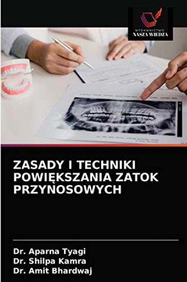 Zasady I Techniki PowiEkszania Zatok Przynosowych