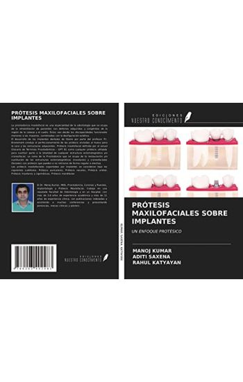 PRÓTESIS MAXILOFACIALES SOBRE IMPLANTES