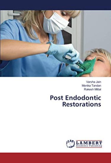 Post Endodontic Restorations