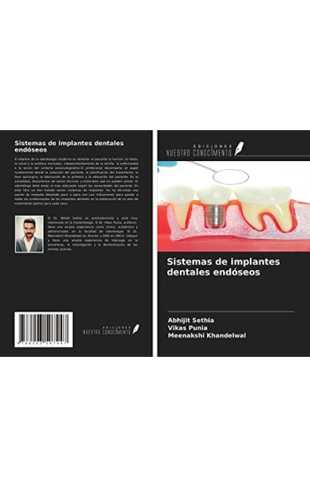 Sistemas de implantes dentales endóseos