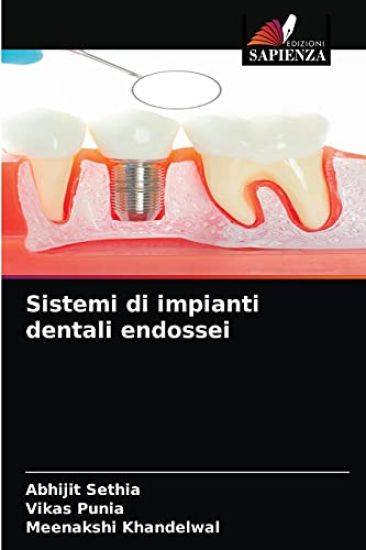 Sistemi di impianti dentali endossei