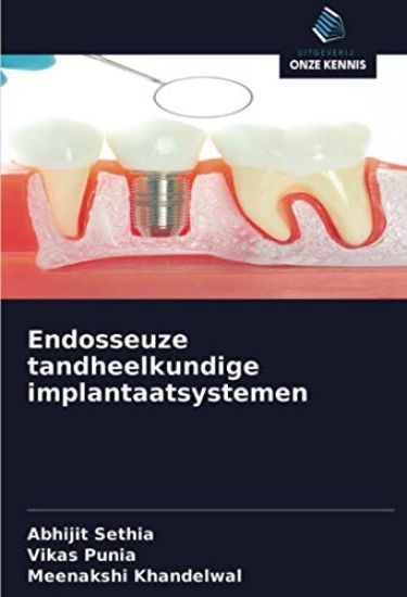 Endosseuze tandheelkundige implantaatsystemen