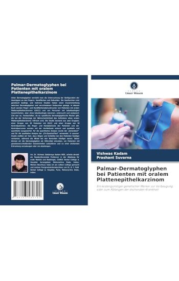 Palmar-Dermatoglyphen bei Patienten mit oralem Plattenepithelkarzinom