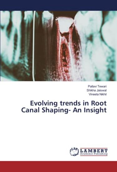 Evolving trends in Root Canal Shaping- An Insight