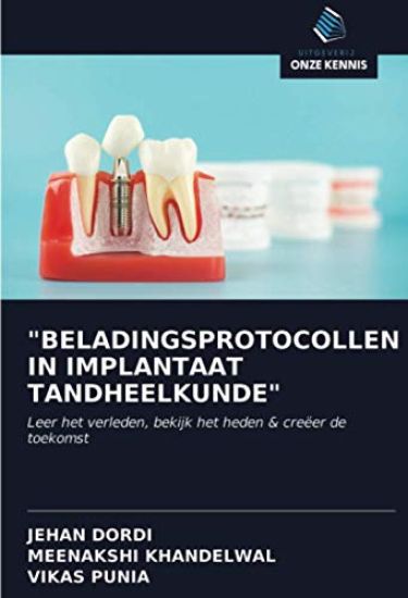 "BELADINGSPROTOCOLLEN IN IMPLANTAAT TANDHEELKUNDE"