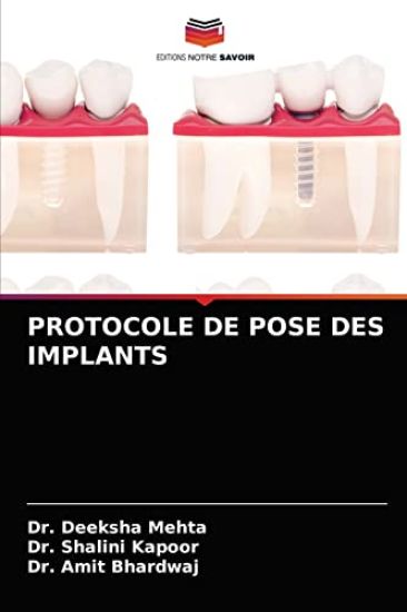 Protocole de Pose Des Implants – Deeksha Mehta, kirjan kansikuva