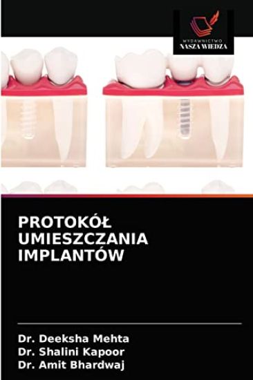 Protokól Umieszczania Implantów – Deeksha Mehta, kirjan kansikuva