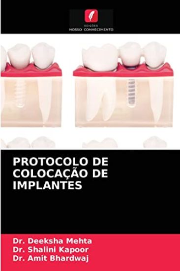 Protocolo de Colocação de Implantes – Deeksha Mehta, kirjan kansikuva