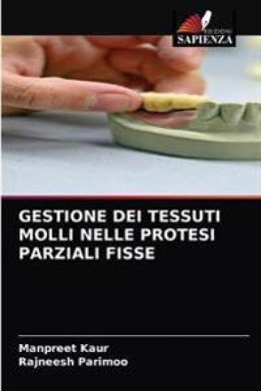 Gestione Dei Tessuti Molli Nelle Protesi Parziali Fisse