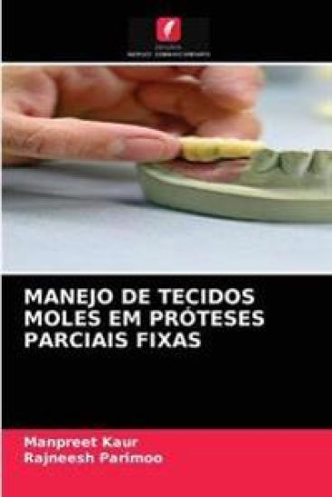 Manejo de Tecidos Moles Em Próteses Parciais Fixas