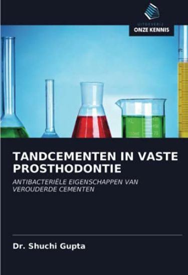 TANDCEMENTEN IN VASTE PROSTHODONTIE